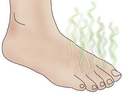 Foot Odor