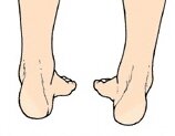 Supination